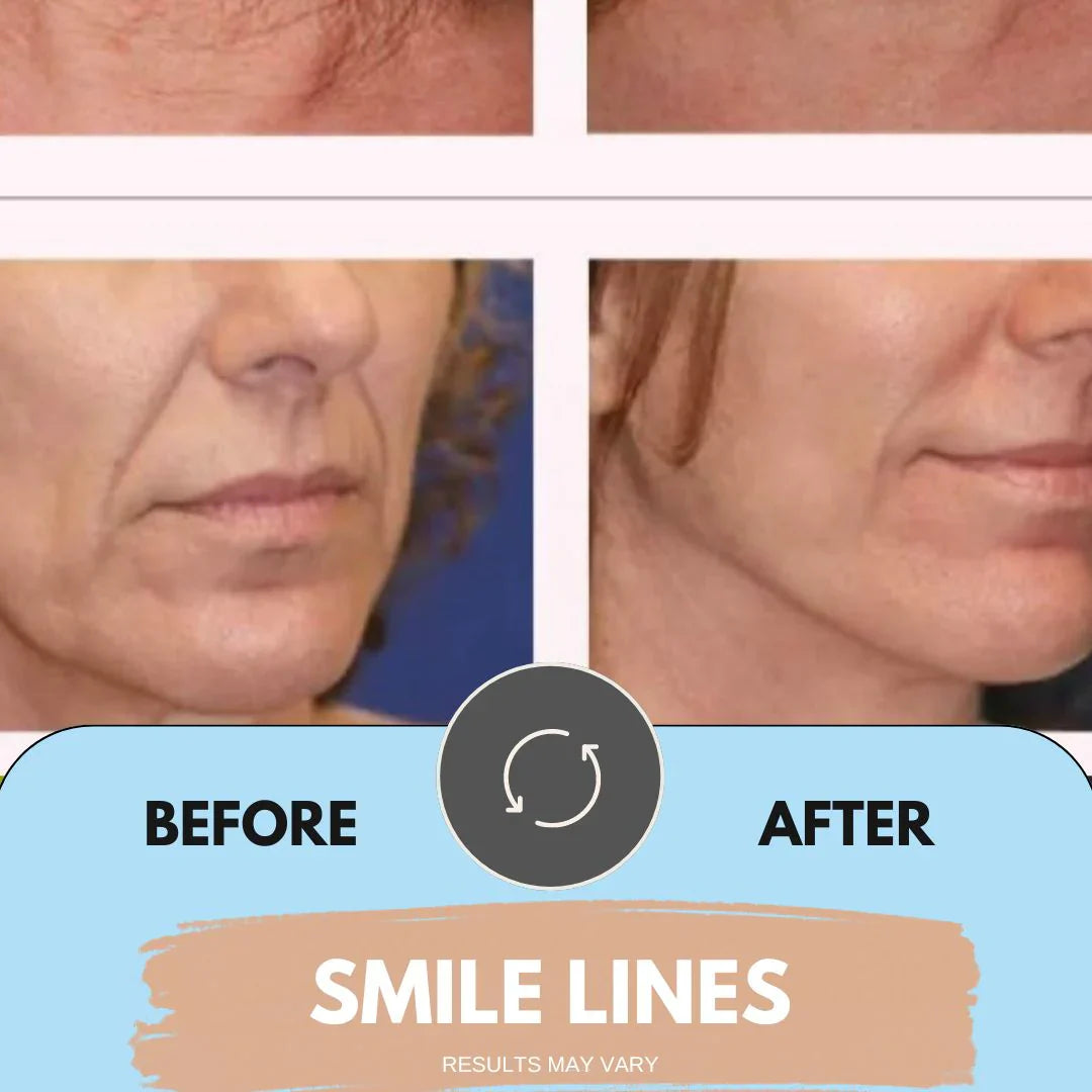 Face Lift Sculptor ~ Chin & Neck Tightening Light Therapy