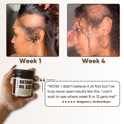 Batana Oil ~ Naturally thicker, healthier hair in just weeks