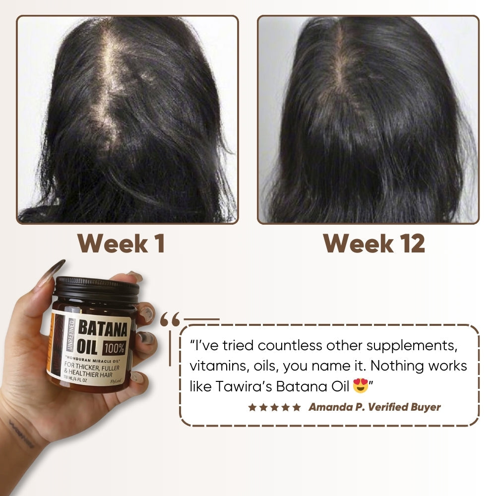 Batana Oil ~ Naturally thicker, healthier hair in just weeks